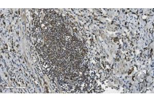 IHC analysis of PARP using anti-PARP antibody (ABIN7602278). (PARP1 抗体  (AA 670-858))