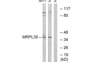 Western blot analysis of extracts from MCF-7 cells and Jurkat cells, using MRPL39 antibody. (MRPL39 抗体  (C-Term))