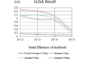 Black line: Control Antigen (100 ng),Purple line: Antigen (10 ng), Blue line: Antigen (50 ng), Red line:Antigen (100 ng) (Parkin 抗体  (AA 1-144))