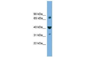 Western Blot showing VPS16 antibody used at a concentration of 1-2 ug/ml to detect its target protein. (VPS16 抗体  (Middle Region))
