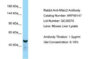 Western Blotting (WB) image for anti-Nuclear Factor of Activated T-Cells, Cytoplasmic, Calcineurin-Dependent 2 (NFAT1) (N-Term) antibody (ABIN2787953)