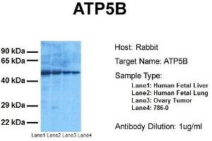 Western Blotting (WB) image for anti-ATP Synthase, H+ Transporting, Mitochondrial F1 Complex, beta Polypeptide (ATP5B) (C-Term) antibody (ABIN2783269)