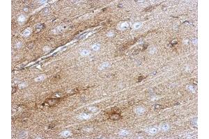 Immunohistochemistry (IHC) image for anti-Superoxide Dismutase 1, Soluble (SOD1) (C-Term) antibody (ABIN2854826)