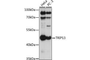 Western blot analysis of extracts of various cell lines, using TRIP13 antibody (ABIN7270823) at 1:1000 dilution. (TRIP13 抗体  (AA 1-120))