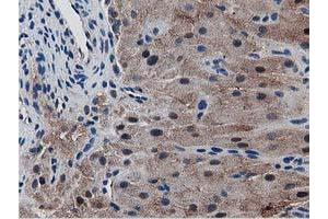 Image no. 2 for anti-Sequestosome 1 (SQSTM1) antibody (ABIN1499988) (SQSTM1 抗体)