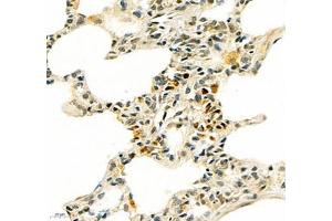 Immunohistochemistry (Paraffin-embedded Sections) (IHC (p)) image for anti-SIX Homeobox 1 (SIX1) antibody (ABIN7075617)