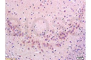 Formalin-fixed and paraffin embedded: rat brain tissue labeled with Anti-FLIP/c FLIP Polyclonal Antibody (ABIN725255), Unconjugated at 1:300 followed by conjugation to the secondary antibody and DAB staining (FLIP 抗体  (AA 7-100))