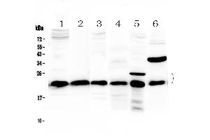 Western blot analysis of PARK7 / DJ1 using anti-PARK7 / DJ1 antibody . (PARK7/DJ1 抗体  (AA 2-189))