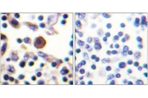 Immunohistochemistry (IHC) image for anti-Interleukin 9 Receptor (IL9R) (AA 472-521) antibody (ABIN2888887) (IL9 Receptor 抗体  (AA 472-521))
