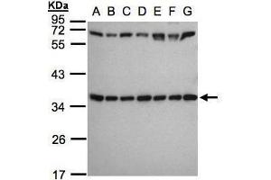 WB Image Sample(30 ug whole cell lysate) A: 293T B: A431 , C: H1299 D: HeLa S3 , E: Hep G2 , F: MOLT4 , G: Raji , 12% SDS PAGE antibody diluted at 1:1000 (RPS3A 抗体)
