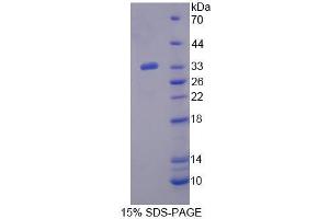 SDS-PAGE (SDS) image for Phospholipase C delta 3 (PLCd3) (AA 528-789) protein (His tag) (ABIN4990049) (Phospholipase C delta 3 Protein (PLCd3) (AA 528-789) (His tag))