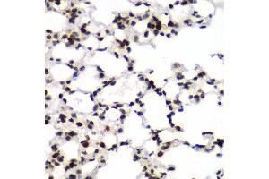 Immunohistochemistry of paraffin-embedded mouse lung using TEAD1 antibody at dilution of 1:100 (x40 lens). (TEAD1 抗体)