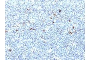 Formalin-fixed, paraffin-embedded human tonsil stained with HLA-Aw32 / HLA-A25 antibody (CATA-1). (HLA-Aw32-&-HLA-A25 (MHC-I) 抗体)