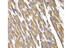 Immunohistochemistry of paraffin-embedded Rat heart using SDHA Polyclonal Antibody at dilution of 1:100 (40x lens). (SDHA 抗体)