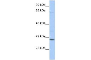 WB Suggested Anti-TGIF2LX Antibody Titration:  0. (TGIF2LX 抗体  (Middle Region))