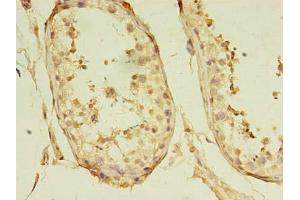 Immunohistochemistry of paraffin-embedded human testis tissue using ABIN7153277 at dilution of 1:100 (GKAP1 抗体  (AA 21-366))