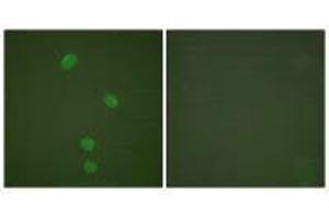 Immunofluorescence analysis of HepG2 cells, using MCM5 antibody. (MCM5 抗体)