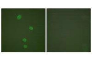 Immunofluorescence analysis of HepG2 cells, using MCM5 antibody. (MCM5 抗体)