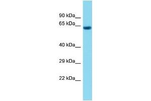 Host: Rabbit Target Name: C1orf94 Sample Type: Fetal Heart lysates Antibody Dilution: 1. (C1ORF94 抗体  (C-Term))