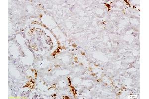 Formalin-fixed and paraffin embedded mouse kidney labeled with Anti AAK1 Polyclonal Antibody, Unconjugated  at 1:200 followed by conjugation to the secondary antibody and DAB staining (AAK1 抗体  (AA 301-400))