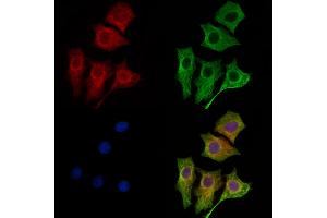 ABIN6261731 and ABIN6269136 staining HepG2 cells by IF/ICC. (FGFR1 抗体  (C-Term))