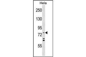 Formalin-fixed and paraffin-embedded human cancer tissue reacted with the primary antibody, which was peroxidase-conjugated to the secondary antibody, followed by AEC staining.