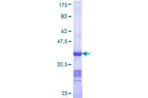 NEDD1 Protein (AA 561-660) (GST tag)