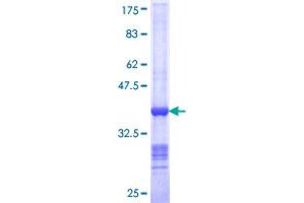 NEDD1 Protein (AA 561-660) (GST tag)