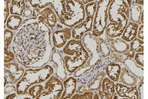 Immunohistochemistry (IHC) image for anti-Sema Domain, Immunoglobulin Domain (Ig), Short Basic Domain, Secreted, (Semaphorin) 3A (SEMA3A) (C-Term) antibody (ABIN6264975)