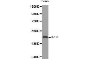 Western Blotting (WB) image for anti-Interferon Regulatory Factor 3 (IRF3) antibody (ABIN1873267) (IRF3 抗体)