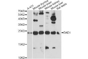 Western blot analysis of extracts of various cell lines, using DAD1 antibody. (DAD1 抗体)