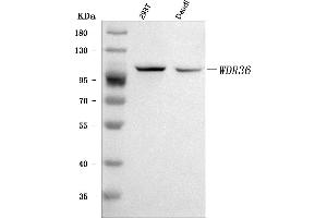 Western blot analysis of WDR36 using anti-WDR36 antibody (ABIN7602409).
