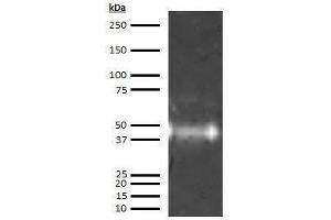 Western Blotting (WB) image for anti-Orosomucoid 1 (ORM1) antibody (ABIN613603) (ORM1 抗体)
