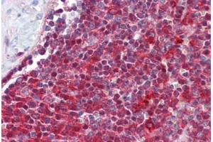 Immunohistochemistry (IHC) image for anti-Tumor Necrosis Factor Receptor Superfamily, Member 4 (TNFRSF4) (N-Term) antibody (ABIN1804615)