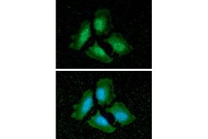 ICC/IF analysis of PPP1CA in HeLa cells line, stained with DAPI (Blue) for nucleus staining and monoclonal anti-human PPP1CA antibody (1:100) with goat anti-mouse IgG-Alexa fluor 488 conjugate (Green).
