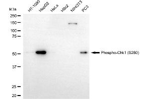 Western blotting analysis using phospho-Chk1 (S280) antibody (ABIN7798037). (Recombinant CHEK1 抗体  (pSer280))