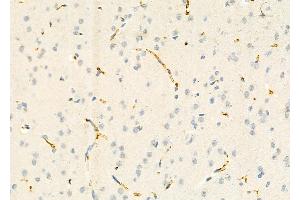 ABIN6265129 and ABIN6273163 at 1/100 staining Rat brain tissue by IHC-P. (SLC38A3 抗体  (Internal Region))