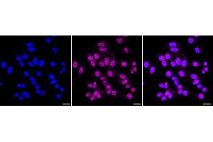 Immunocytochemical staining of HepG2 cells with NR5A2 antibody (ABIN7799662), 1:1,000).