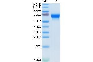 alpha 2 Antiplasmin Protein (AA 28-491) (His tag)