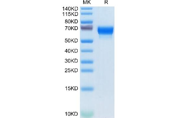 alpha 2 Antiplasmin Protein (AA 28-491) (His tag)