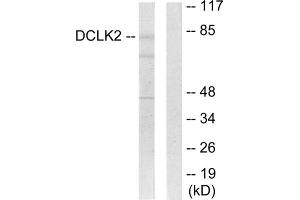 Western blot analysis of extracts from HepG2 cells, using DCLK2 antibody. (DCLK2 抗体  (N-Term))