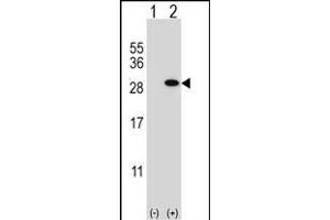 Western blot analysis of GSTT1 (arrow) using rabbit polyclonal GSTT1 Antibody (N-term) (ABIN656825 and ABIN2846035). (GSTT1 抗体  (N-Term))