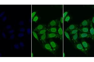 Detection of HDAC6 in Human HepG2 cell using Polyclonal Antibody to Histone Deacetylase 6 (HDAC6) (HDAC6 抗体  (AA 560-811))