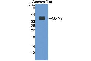 Western blot analysis of the recombinant protein. (MTFMT 抗体  (AA 78-386))