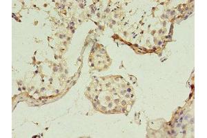 Immunohistochemistry of paraffin-embedded human testis tissue using ABIN7153819 at dilution of 1:100 (GGPS1 抗体  (AA 1-300))