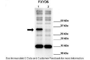 Lanes:   Lane 1: 10ug hFXYD5 transfected 293T lysate Lane 2: 10ug 293T lysate  Primary Antibody Dilution:    1:1000  Secondary Antibody:   Anti-rabbit HRP  Secondary Antibody Dilution:    1:4000  Gene Name:   FXYD5  Submitted by:   Anonymous (FXYD5 抗体  (N-Term))