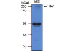 Western blot analysis: The cell lysates of hES(20ug) were resolved by SDS-PAGE, transferred to PVDF membrane and probed with antihuman TRA 1 (1:500). (GRP94 抗体)