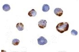 Immunohistochemistry (IHC) image for anti-P21 Protein (Cdc42/Rac)-Activated Kinase 7 (PAK7) (Middle Region) antibody (ABIN1031031) (PAK7 抗体  (Middle Region))