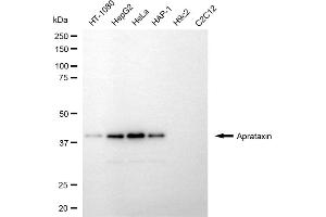 Western blotting analysis using aprataxin antibody (ABIN7797635).