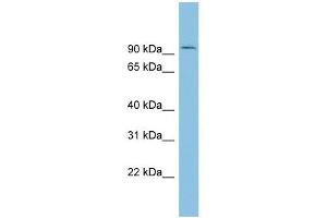 TLK1 antibody used at 1 ug/ml to detect target protein. (TLK1 抗体  (Middle Region))